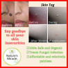 Natures Miracle kasoy cream warts/skin tag remover 5grams
